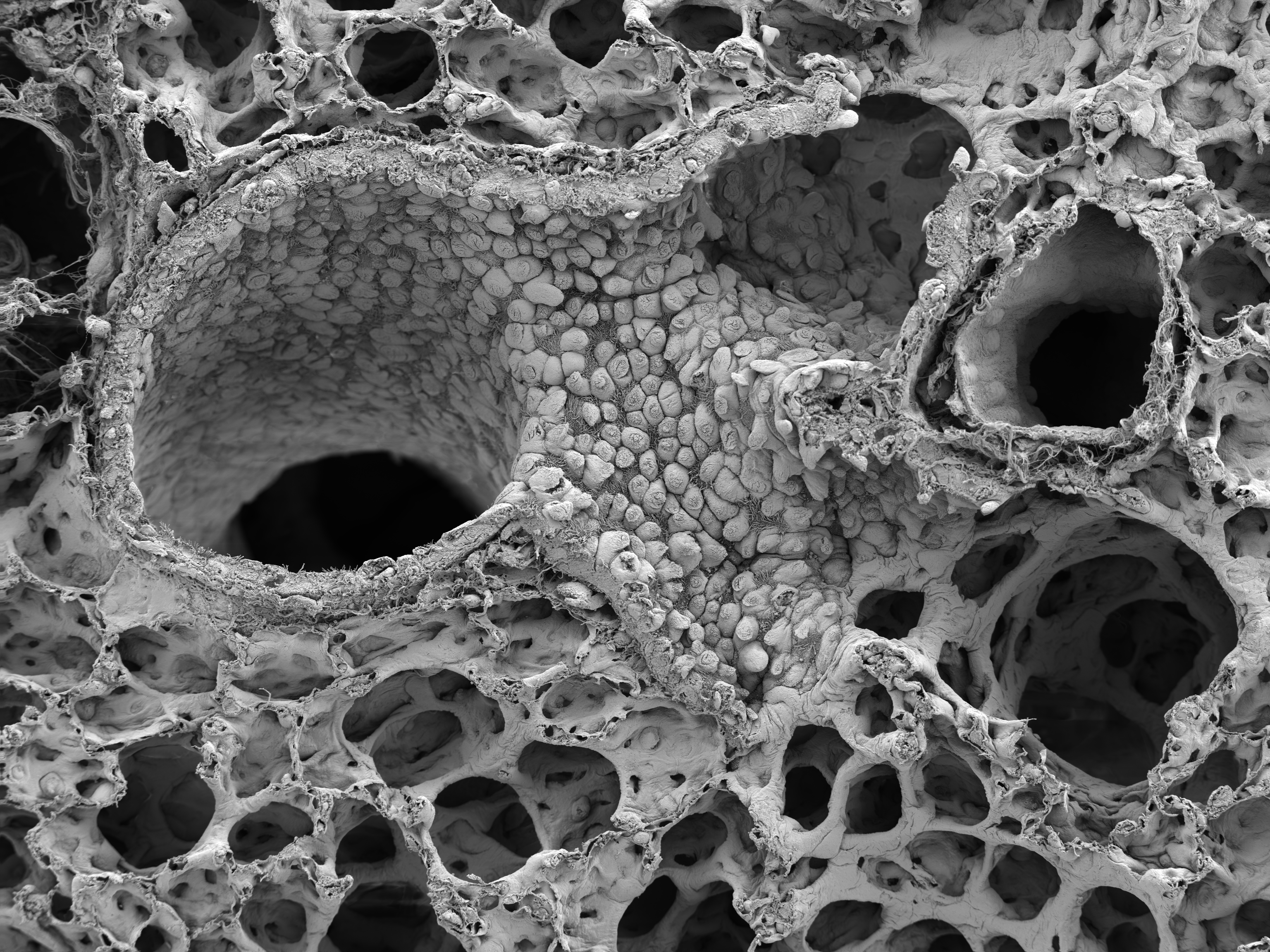 Electron micrograph of a healthy mouse Lung